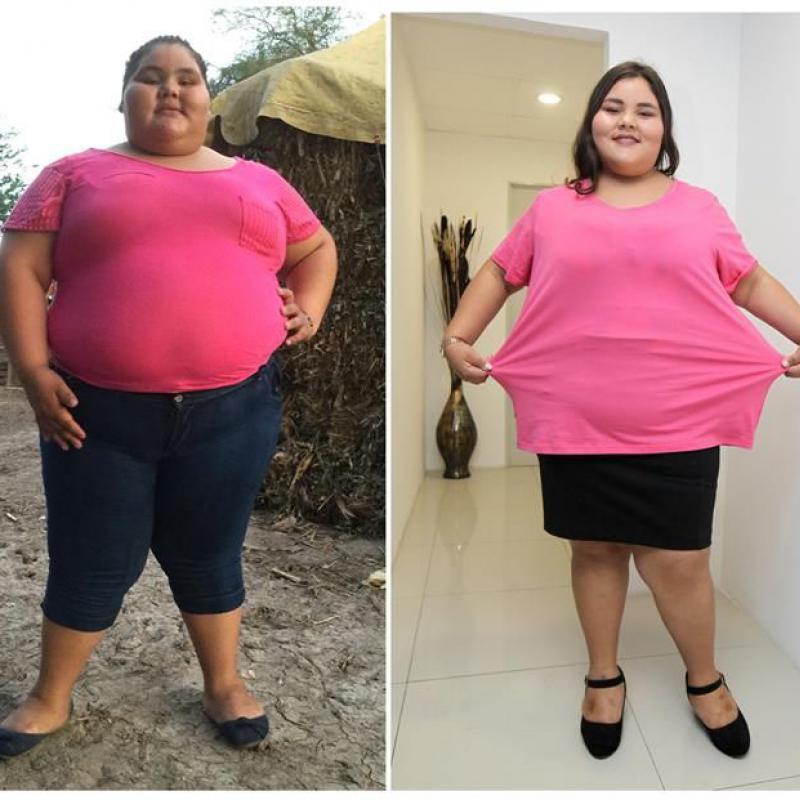 La Chica Que Bajó 90 Kilos Para Festejar Su Cumpleaños De 15 Diario